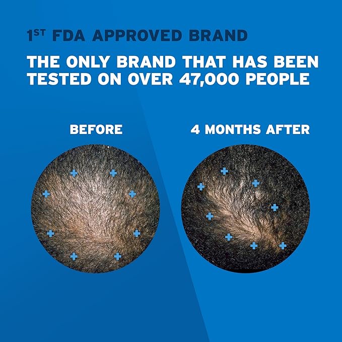 Men's  5% Minoxidil Unscented Foam (Original)